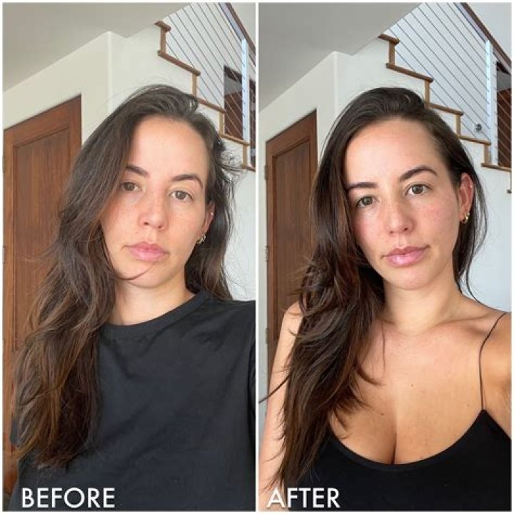 Before And After Pictures Exposed