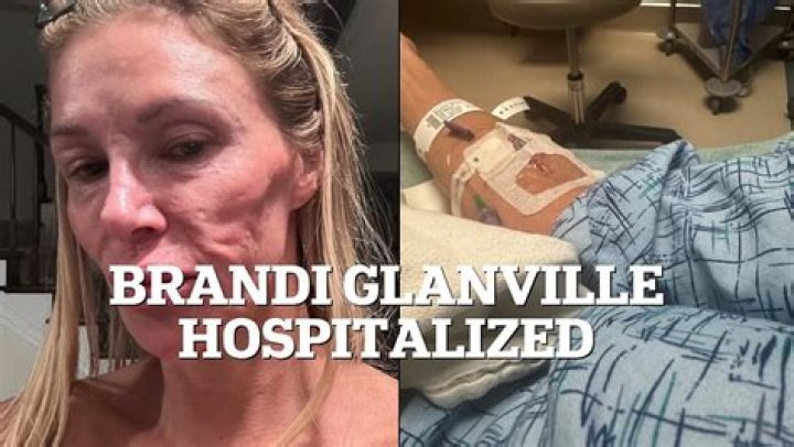 Brandi Glanville in Hospital for Stress-Induced Angioedema After Face Blew Up Like a Basketball (Exc