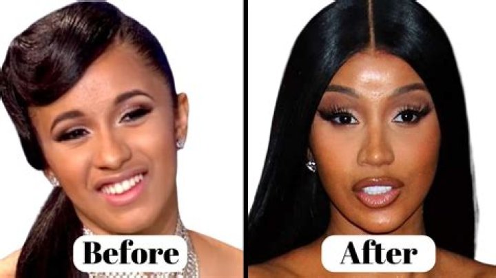 Cardi B's Transformation: Unmasking The Beauty Within